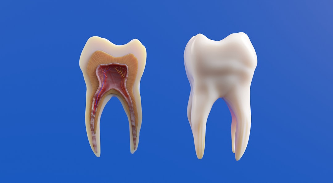 Study Reveals Non-Invasive Cavity Prevention Technique  